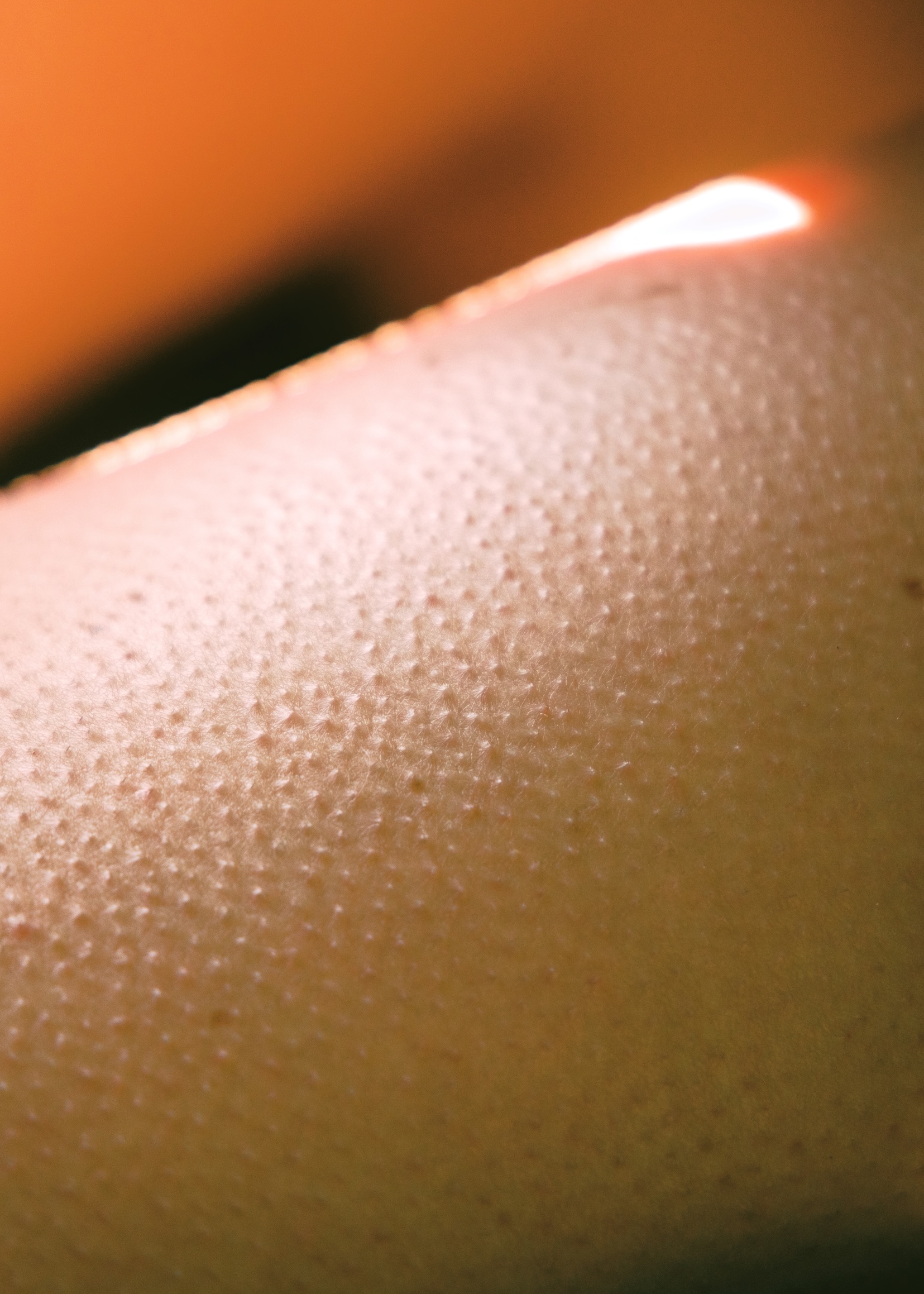 Leland-Next-LACP-3332